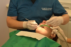 Ефектни зъбни импланти цени 28