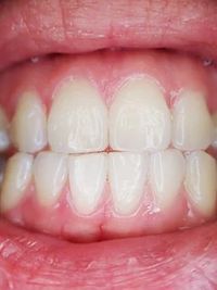 пасти за зъби без флуор - 58327 отстъпки
