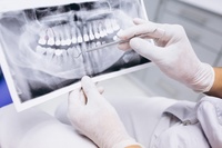 зъболекар русе - 67478 - вземете от нашите предложения