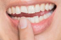 киста на зъб - 51974 бестселъри