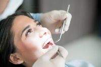 избелване на зъби в домашни условия - 28285 селекции