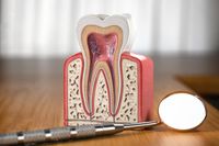 избелване на зъби в домашни условия - 42235 селекции
